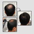 12-Hour Long-Lasting Instant Hair Coverage Fiber Powder Set