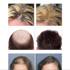 Dense Hair Ball Essence Root Strong Serum