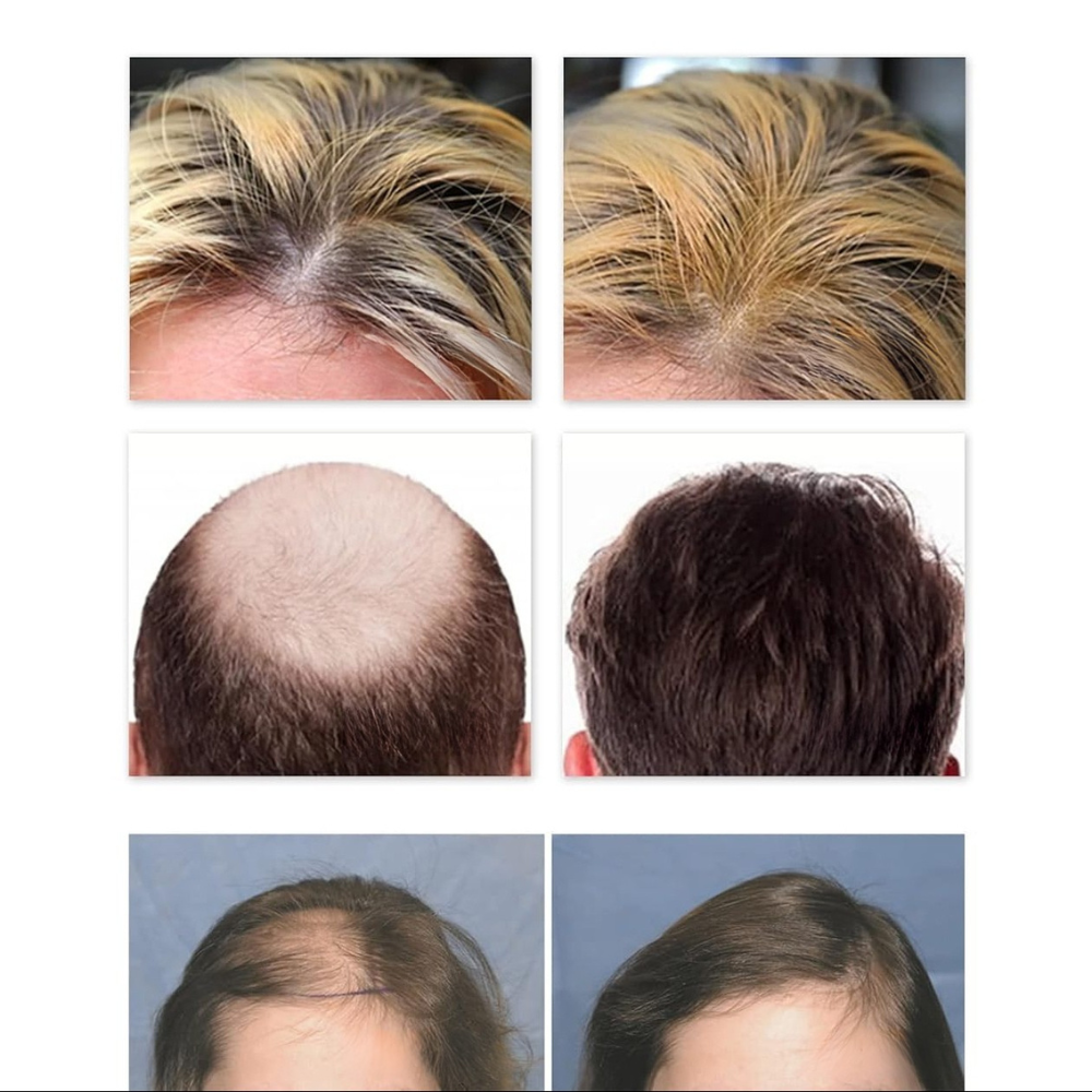 Dense Hair Ball Essence Root Strong Serum
