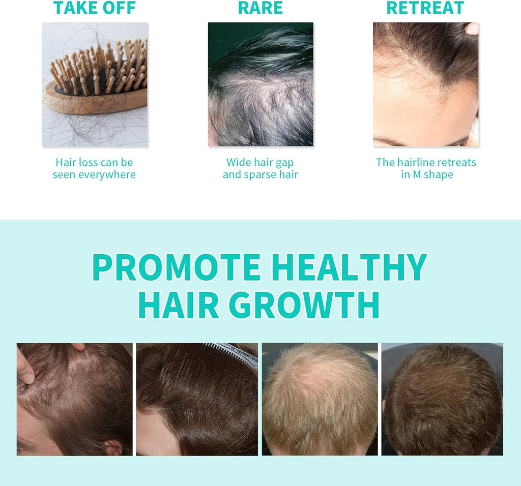 Dense Hair Ball Essence Root Strong Serum